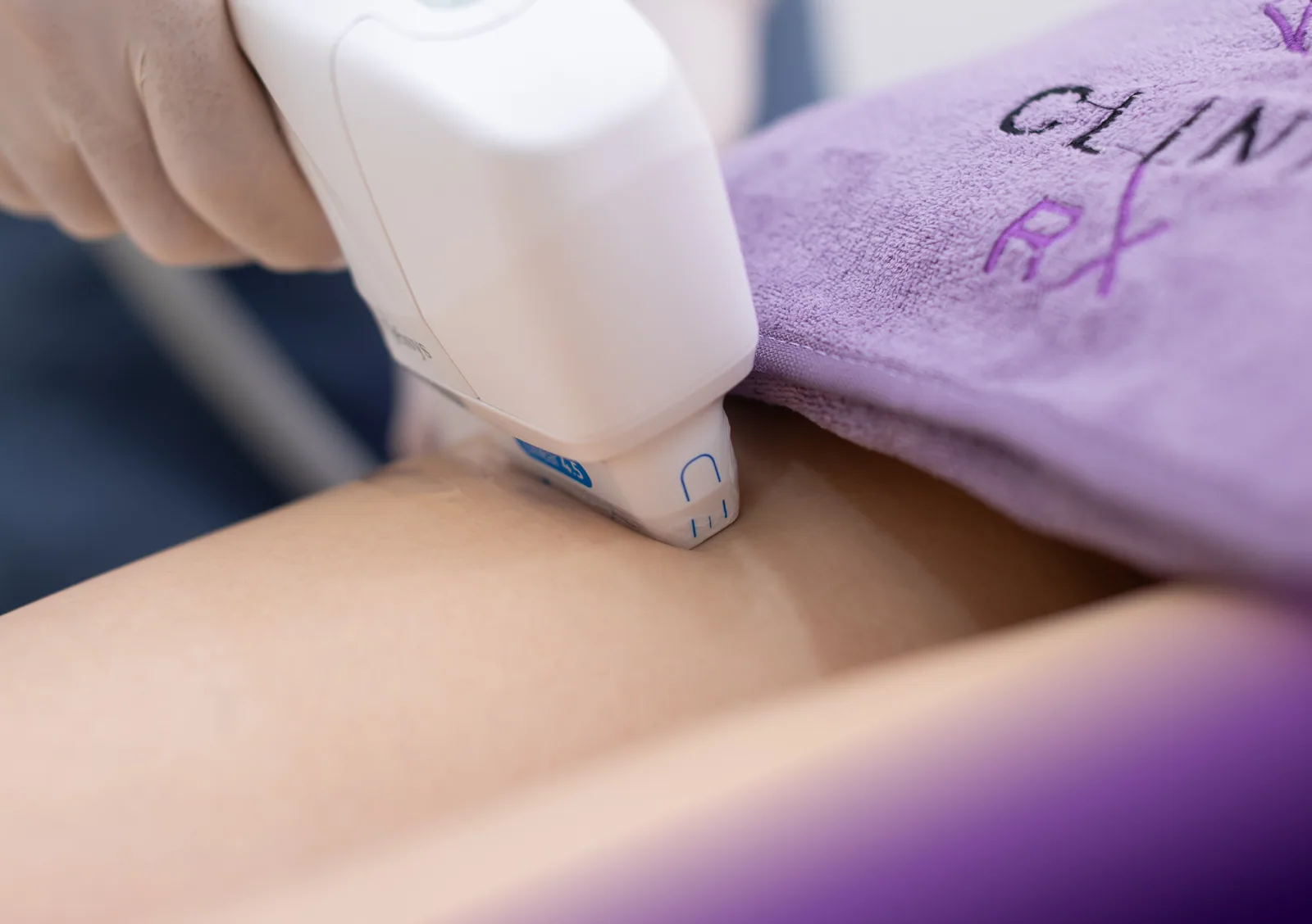 HIFU Body treatment at Clinic RX