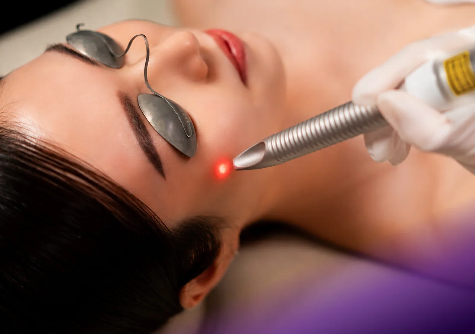 Fotona 4D Lift treatment at Clinic RX