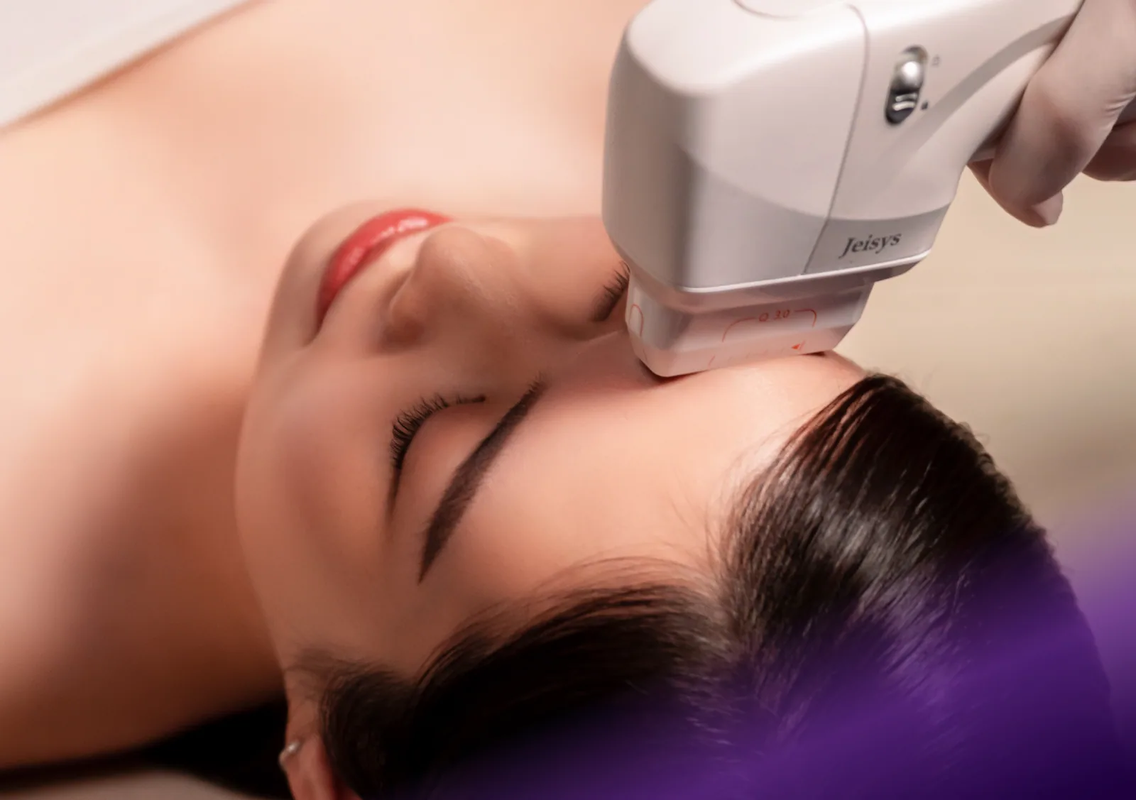 HIFU treatment at Clinic RX