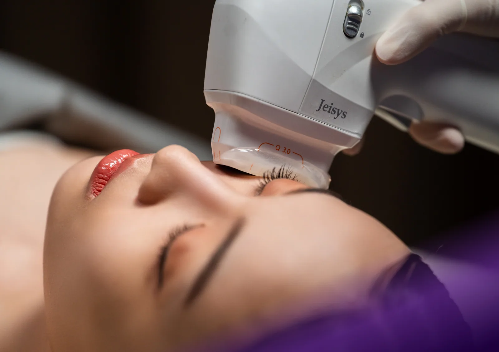 HIFU treatment at Clinic RX
