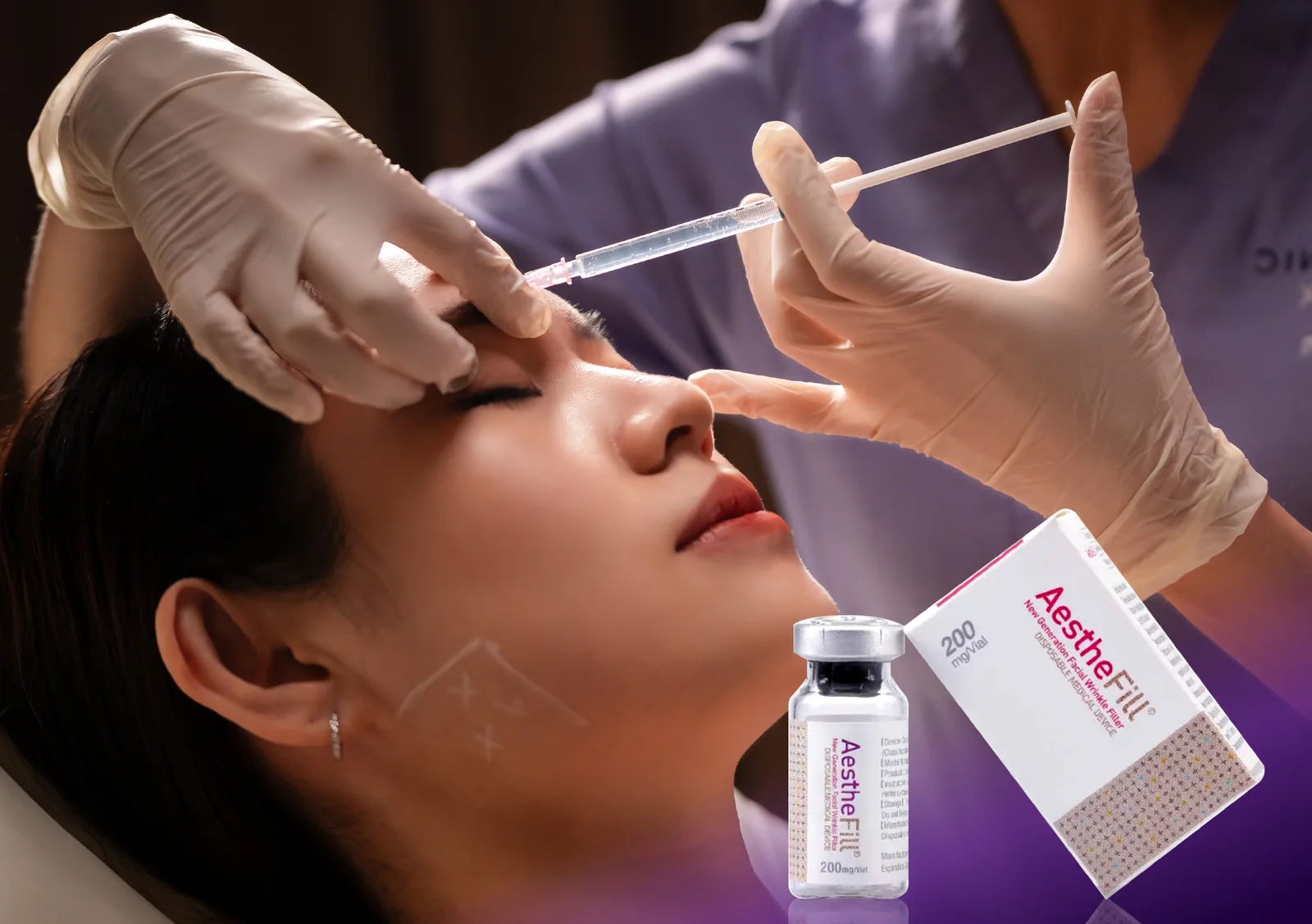 AestheFill treatment at Clinic RX