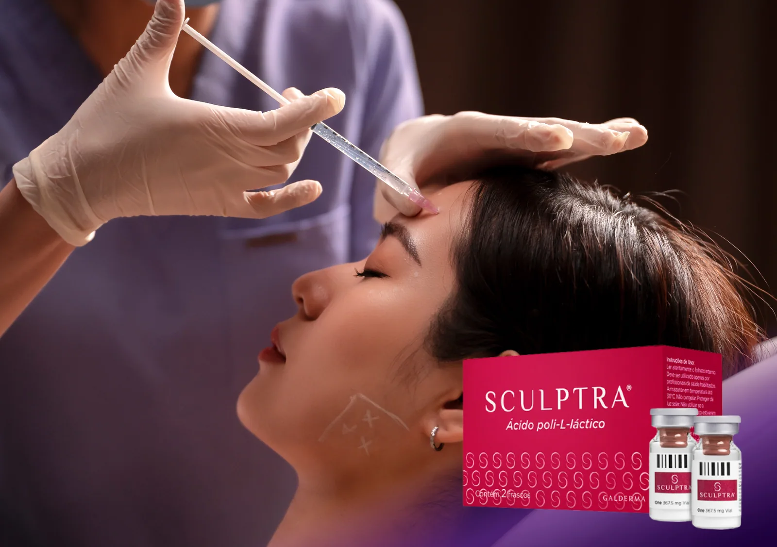 Sculptra treatment at Clinic RX