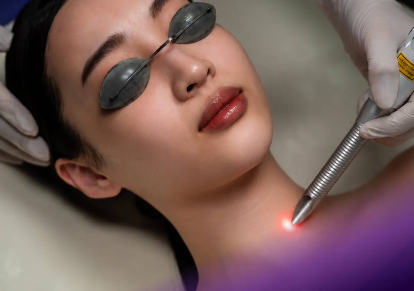 Fotona 4D Lift treatment at Clinic RX
