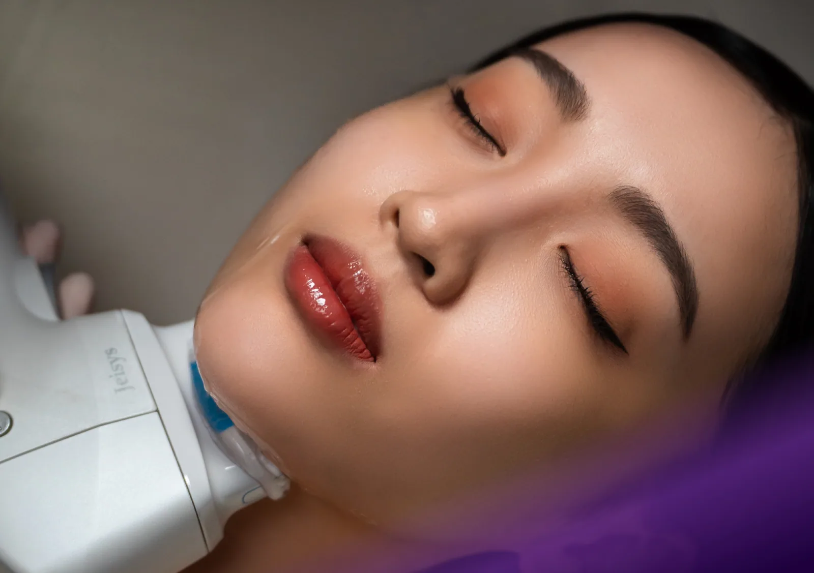 HIFU treatment at Clinic RX