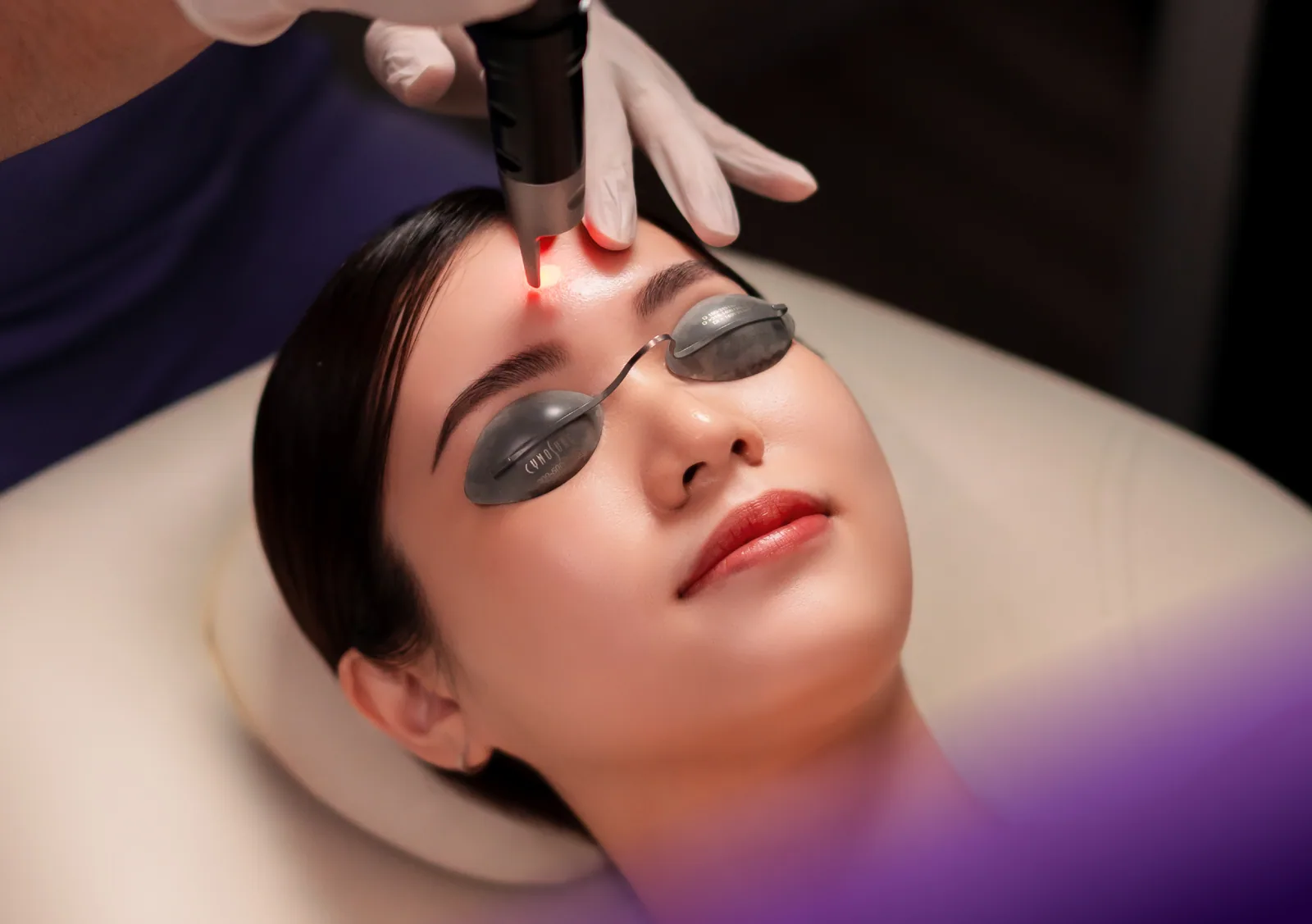 Pico Laser treatment at Clinic RX