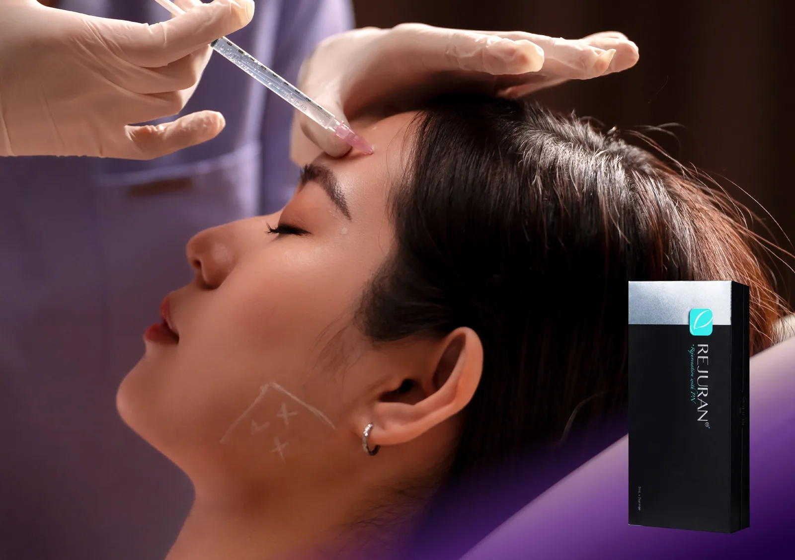 Rejuran treatment at Clinic RX