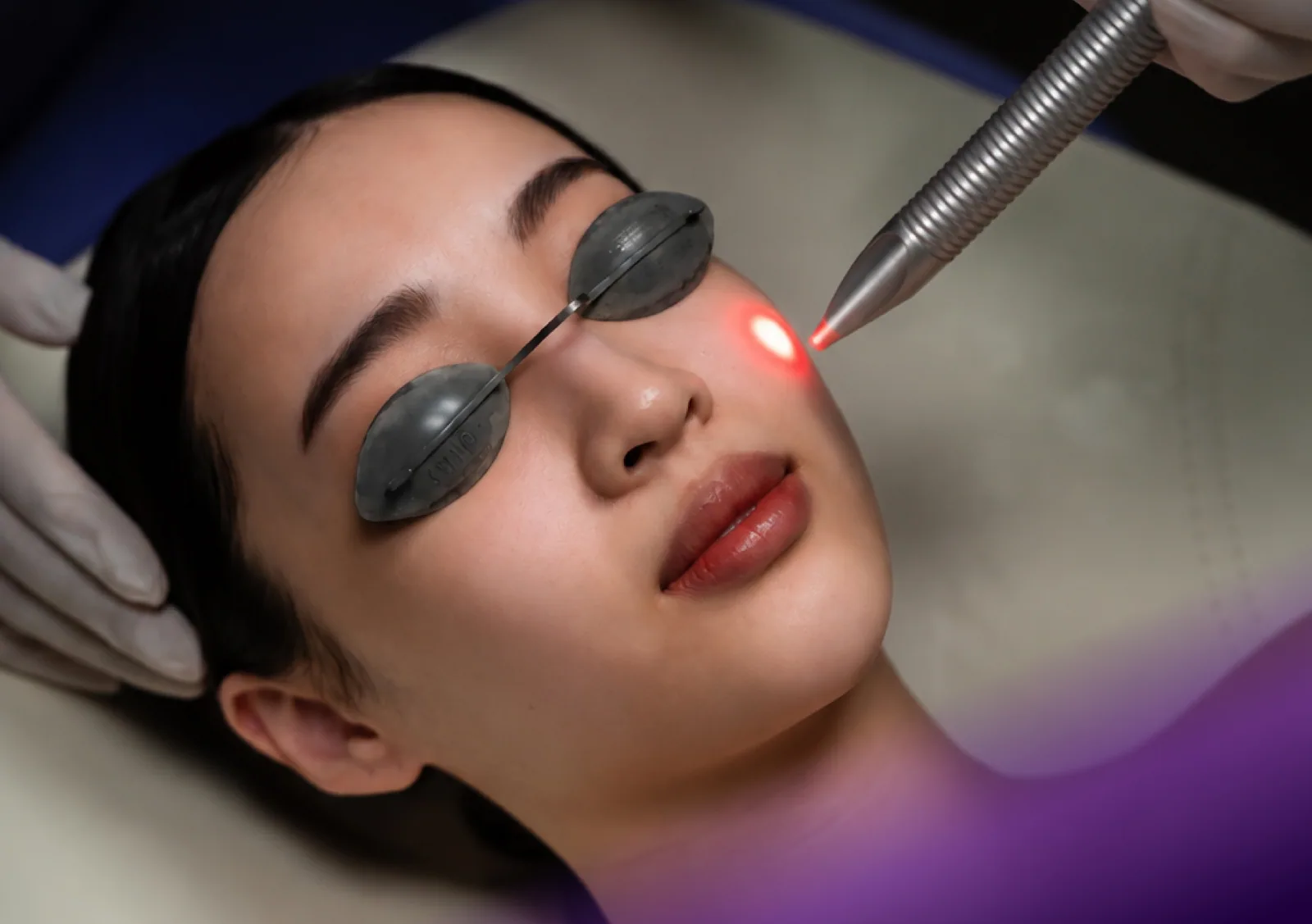 Fotona 4D Lift treatment at Clinic RX