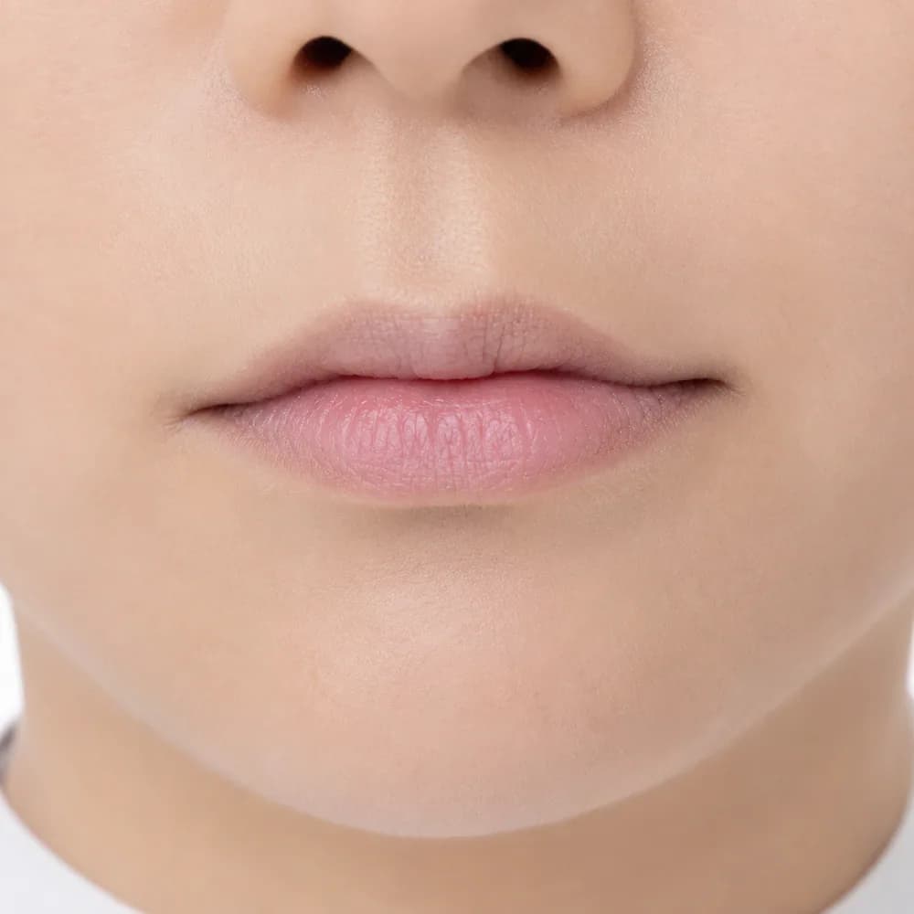 Thin Lips — Asymmetric Lips