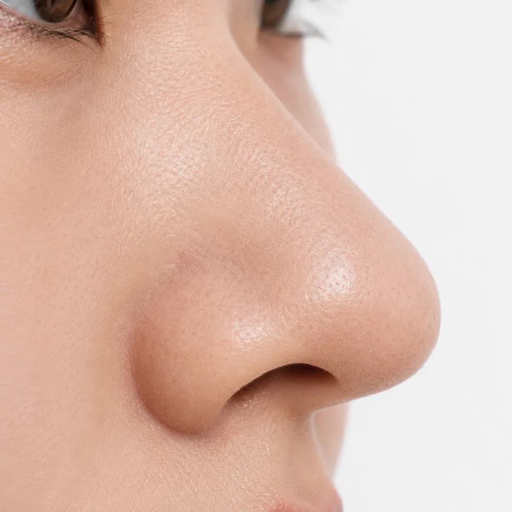 Undefined Nose — Disproportionate Nose