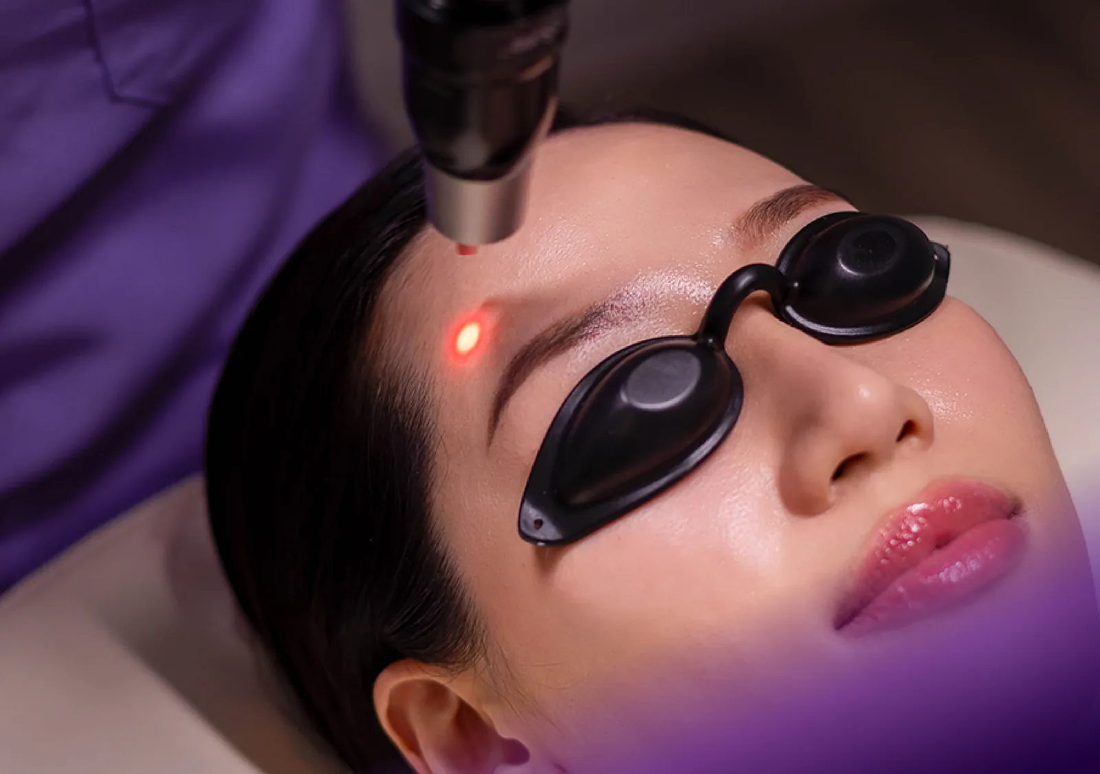 Pico Laser treatment at Clinic RX