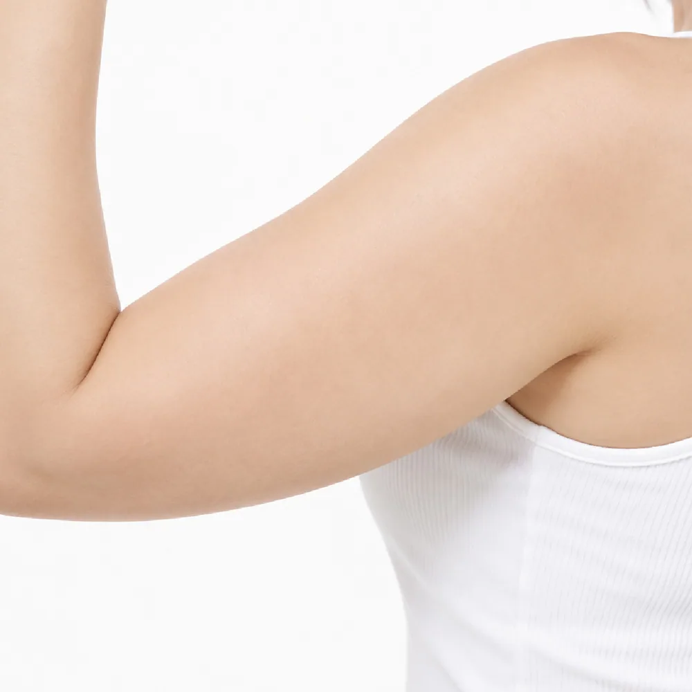Unwanted Fat — Upper Arms