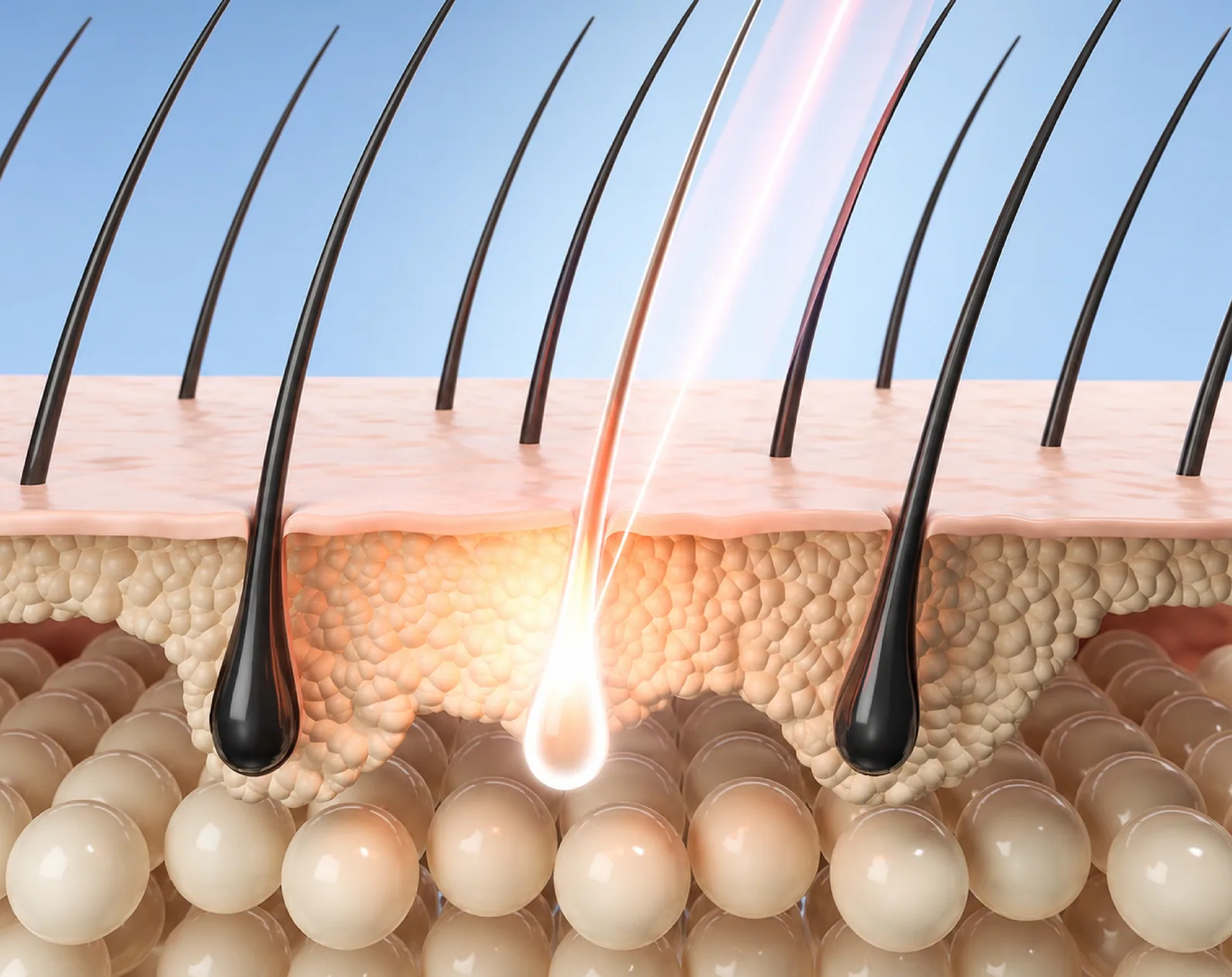 Unwanted Hair assessment at Clinic RX