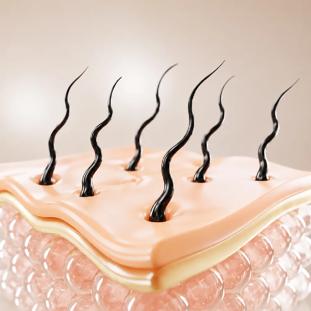 Unwanted Hair — Underarm Hair