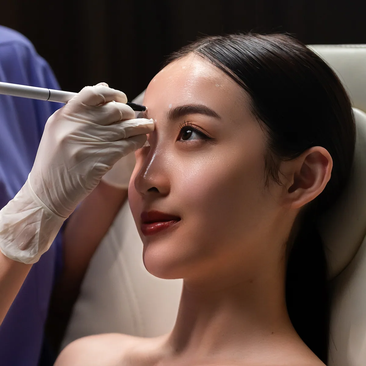 AestheFill treatment step 2