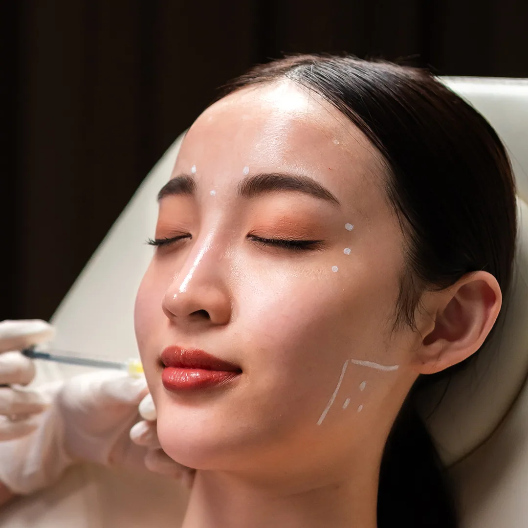 Botulinum Toxin treatment step 3