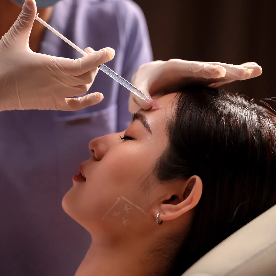 Ellansé treatment step 4