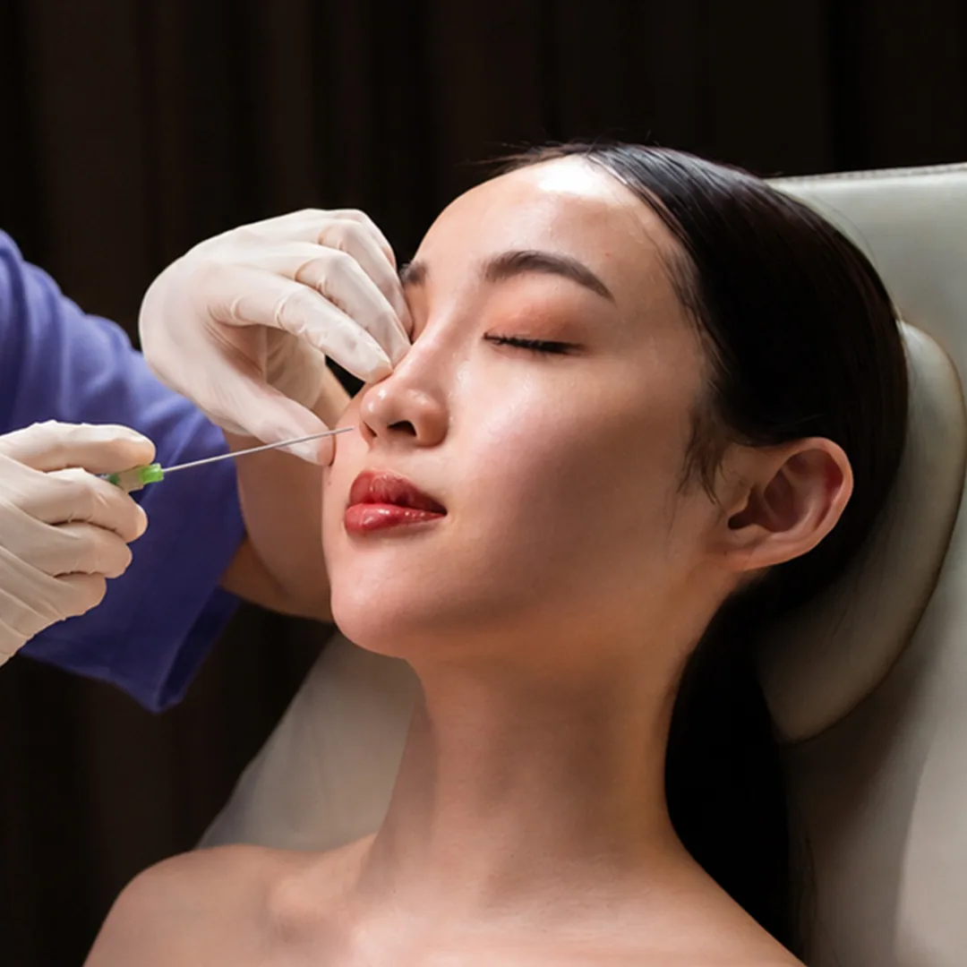 Nose Thread Lift treatment step 4