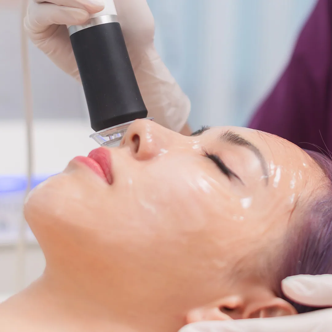 OxyGeneo treatment step 3