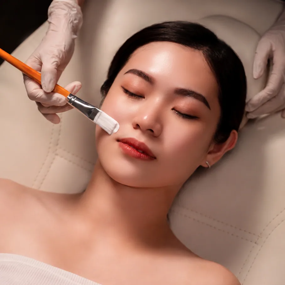 Radiesse treatment step 3