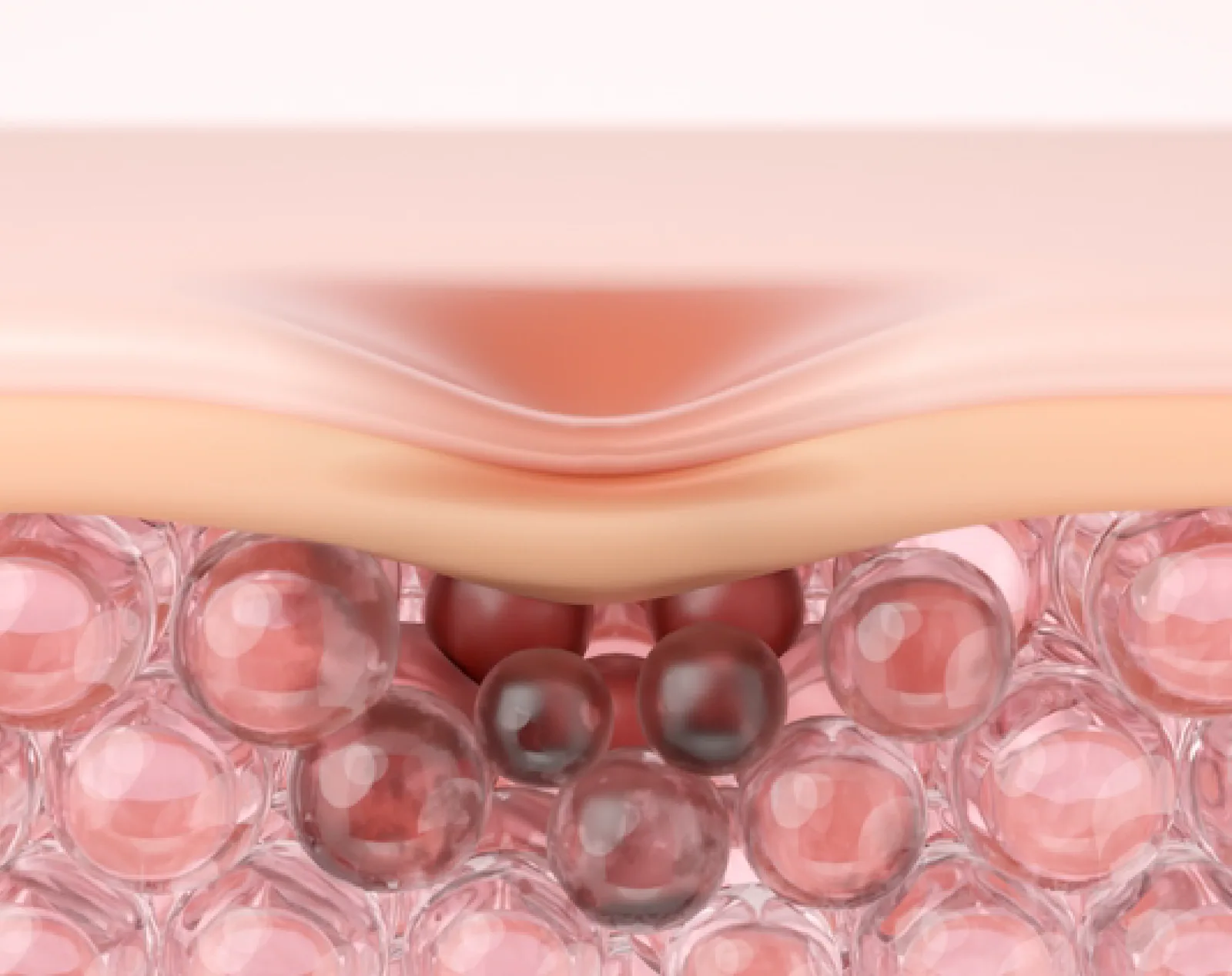 Acne Scars assessment at Clinic RX