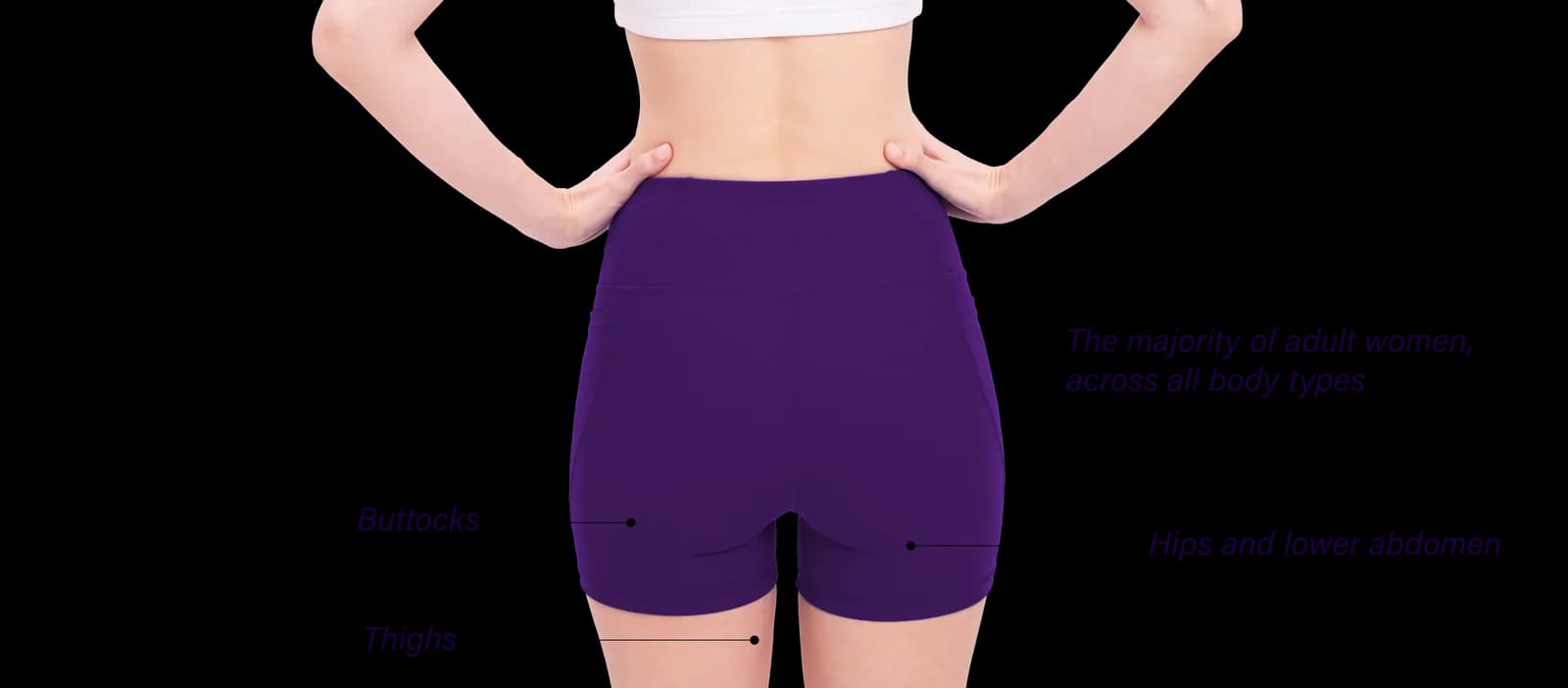 Areas of the face affected by cellulite