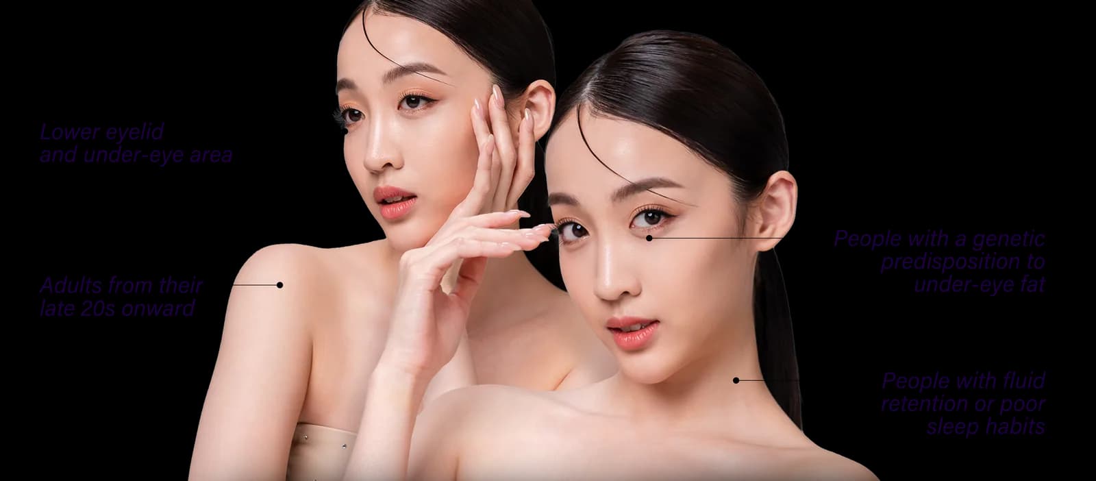 Areas of the face affected by eyebags