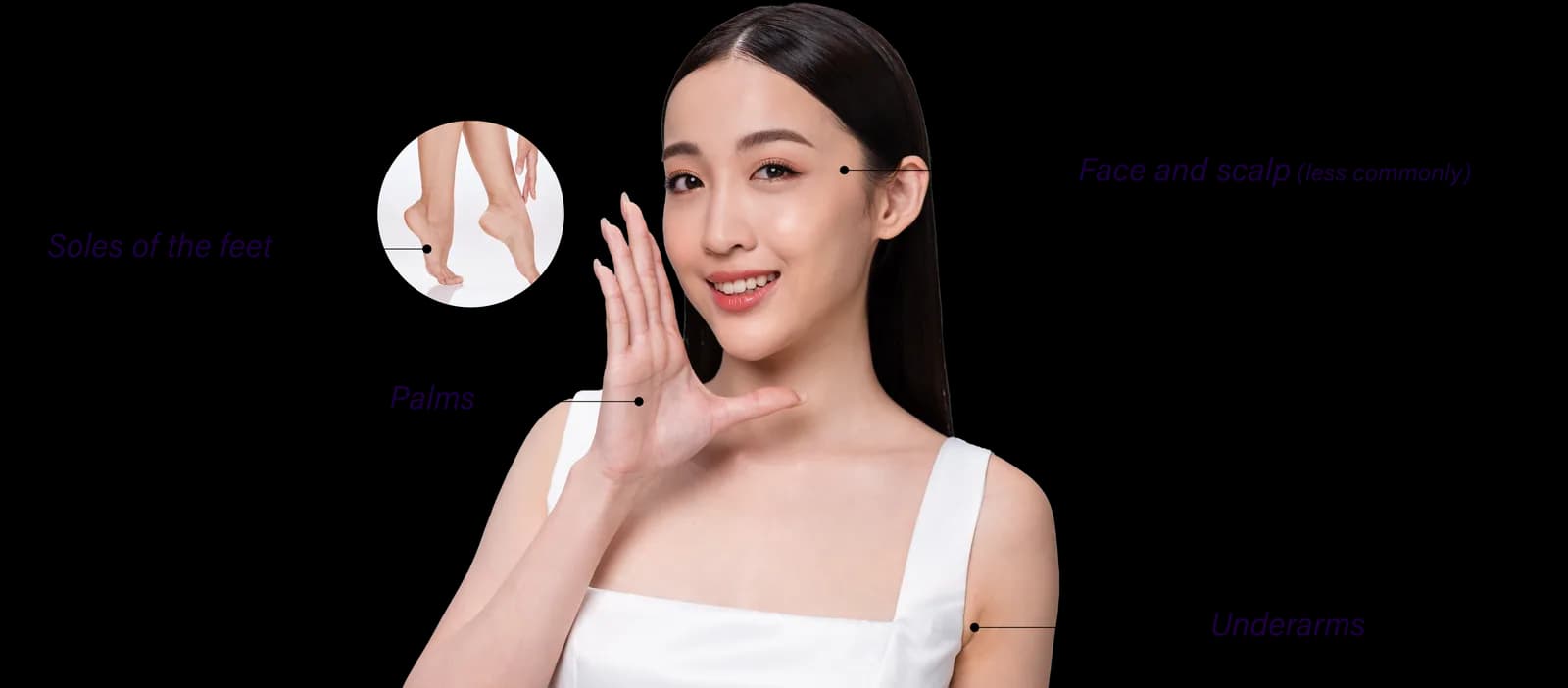 Areas of the face affected by hyperhidrosis