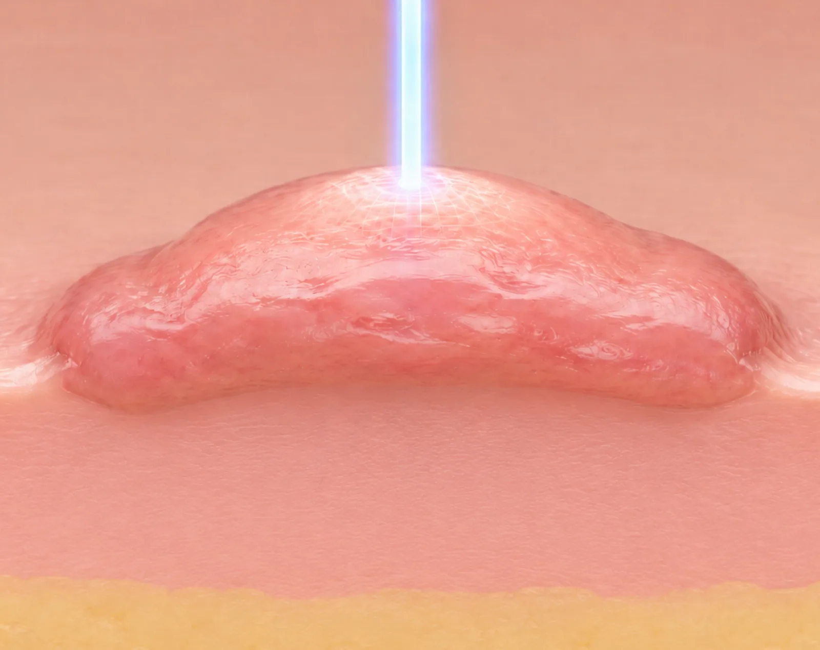 Keloid assessment at Clinic RX