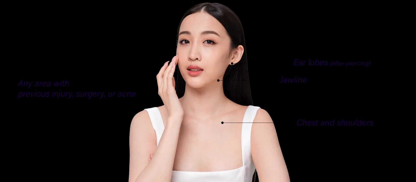 Areas of the face affected by keloid