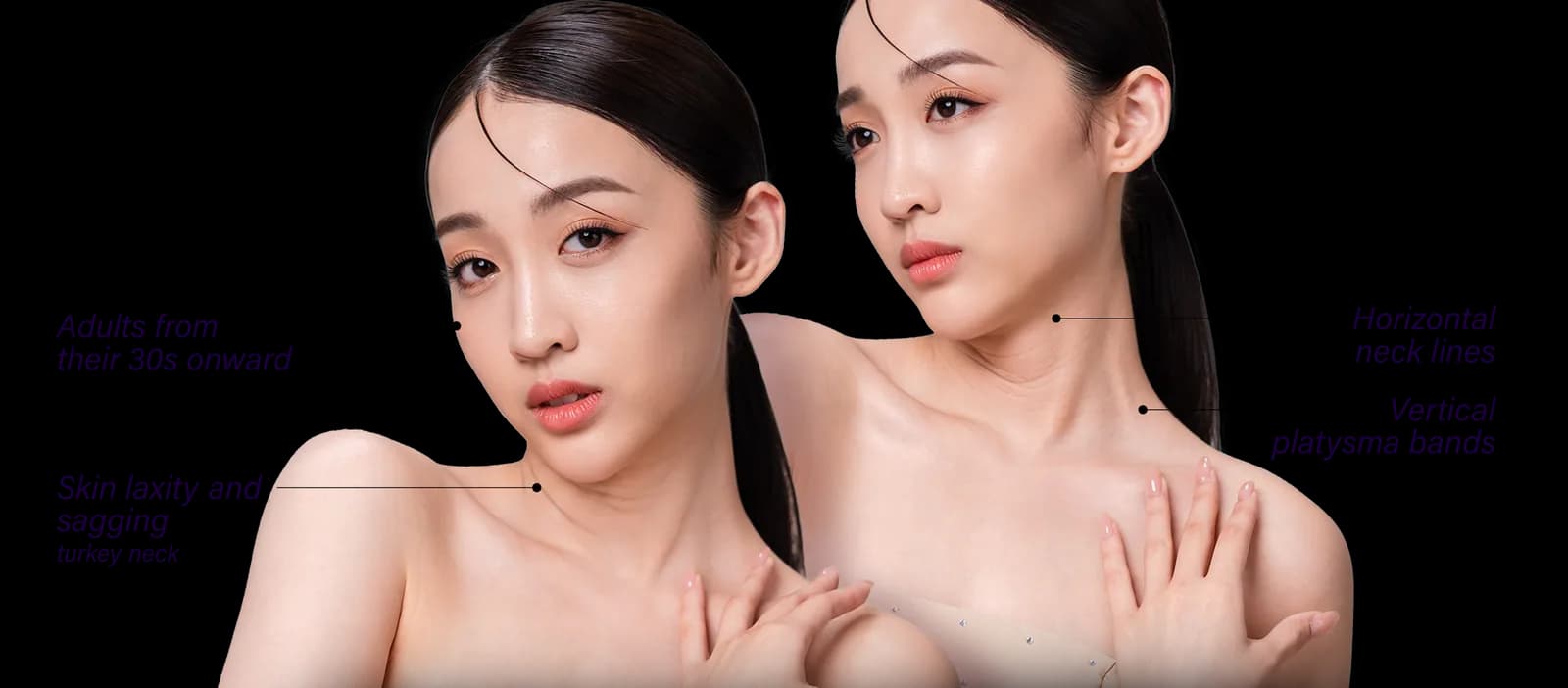 Areas of the face affected by neck lines