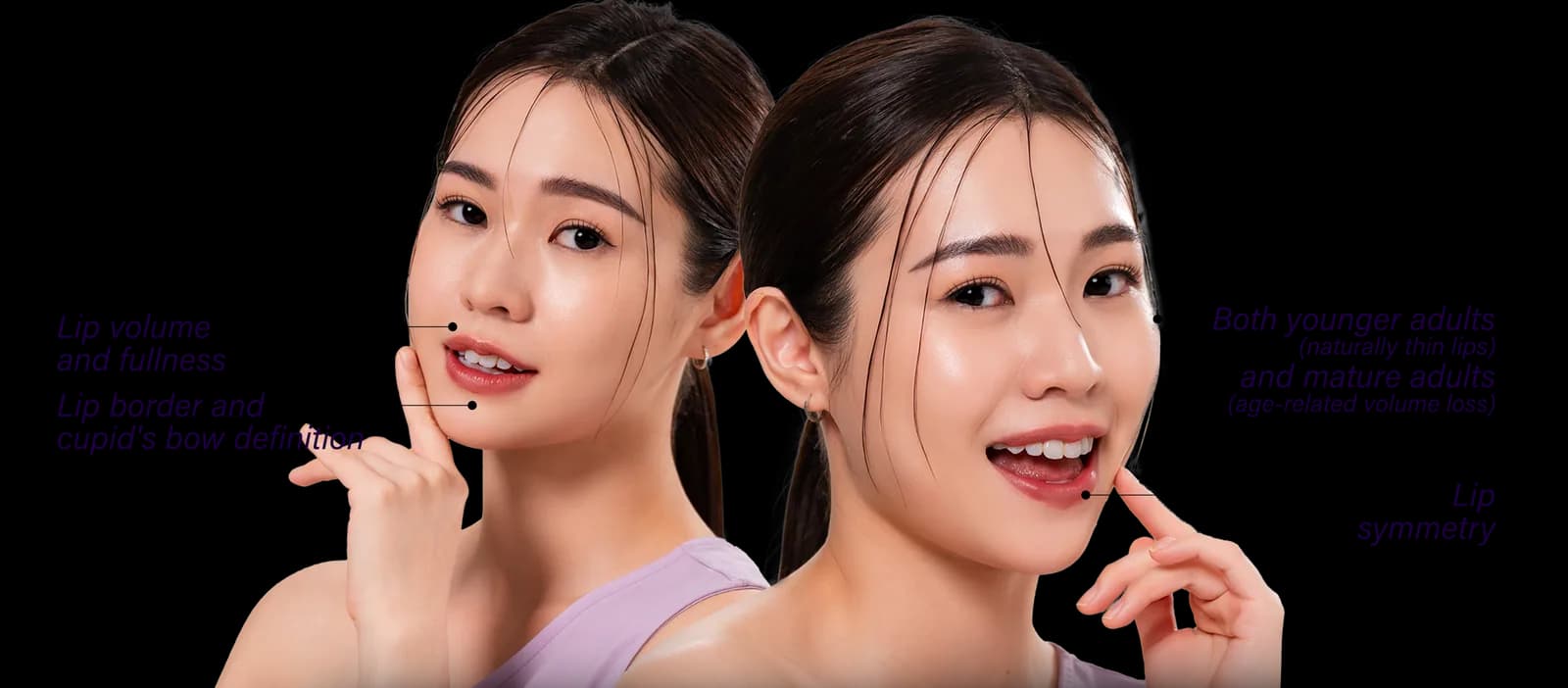 Areas of the face affected by thin lips