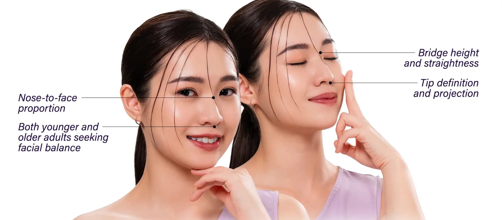 Areas of the face affected by undefined nose