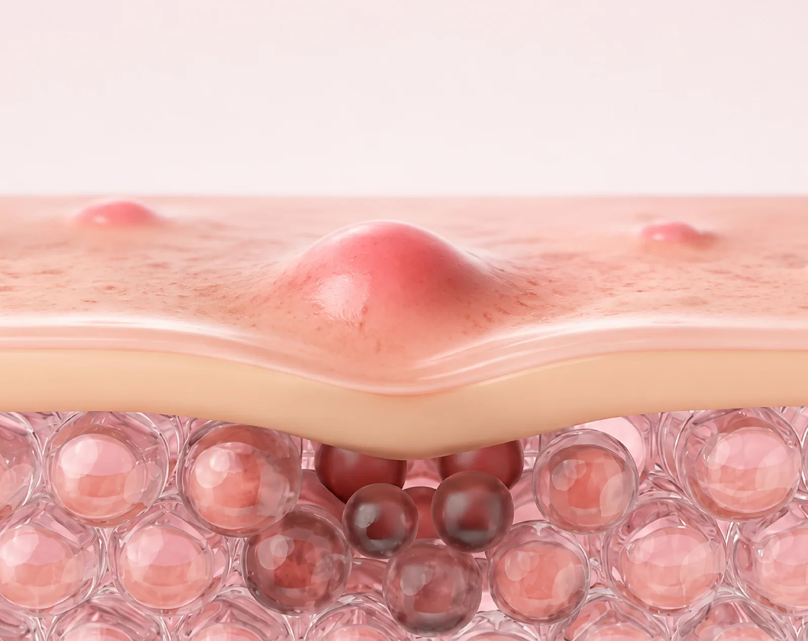 Uneven Skin Texture assessment at Clinic RX