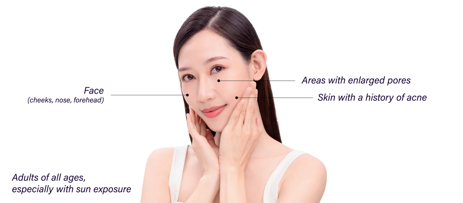 Areas of the face affected by uneven skin texture