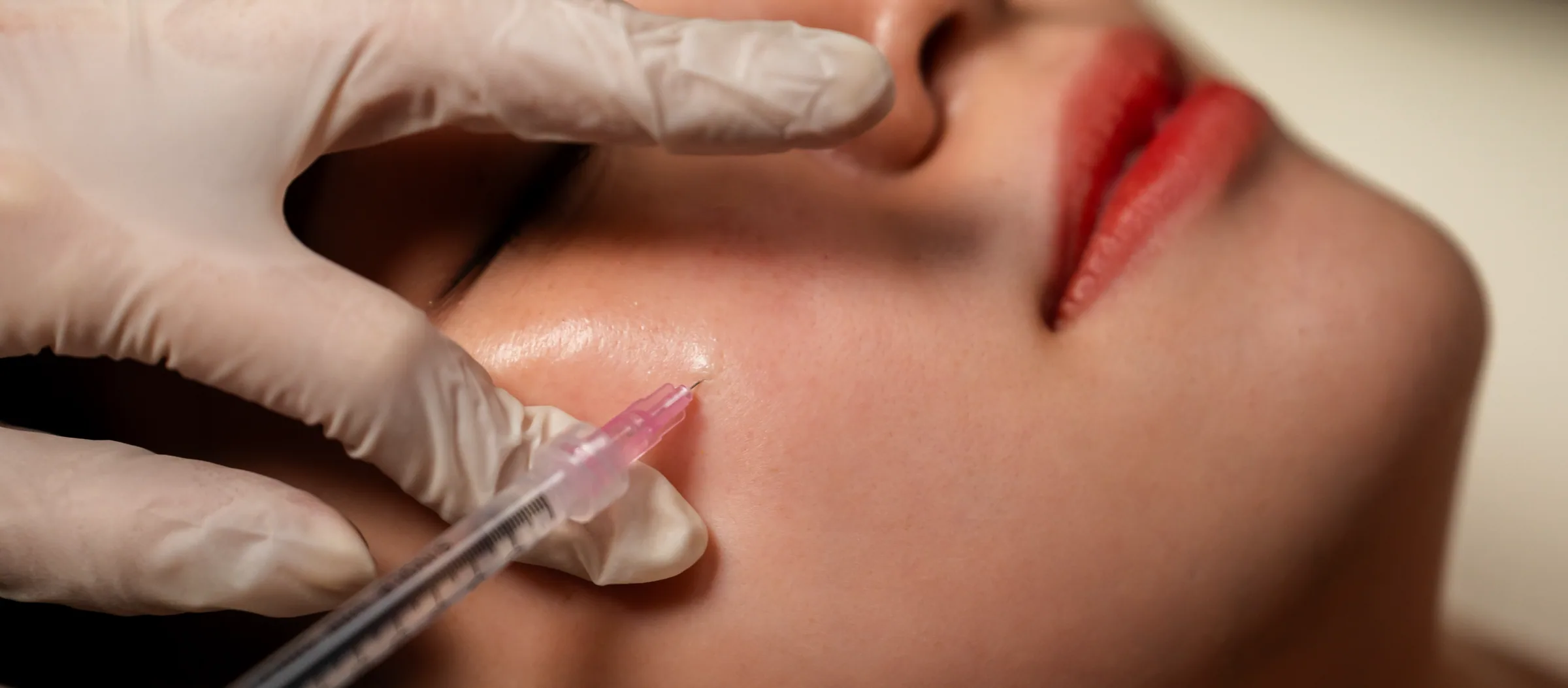Deusaderm treatment in progress
