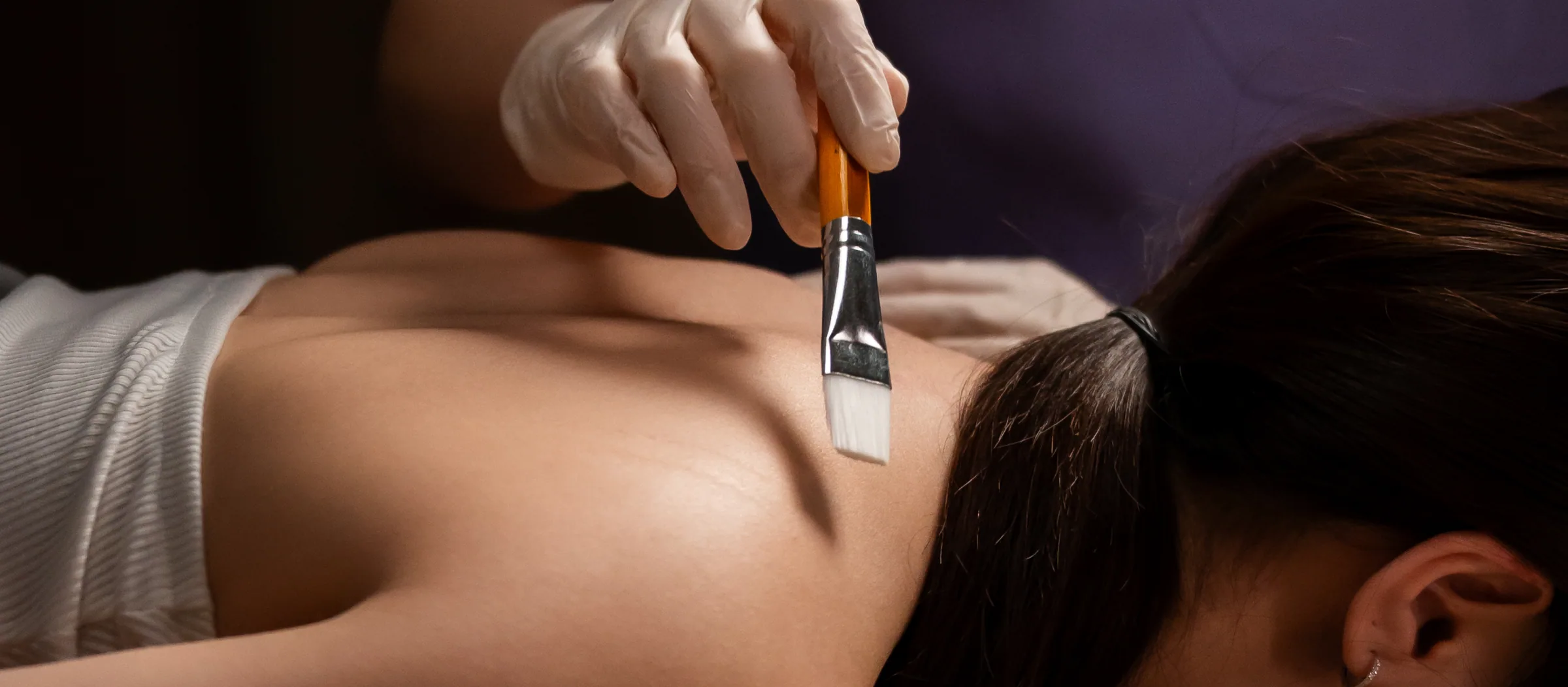 Keloid treatment in progress