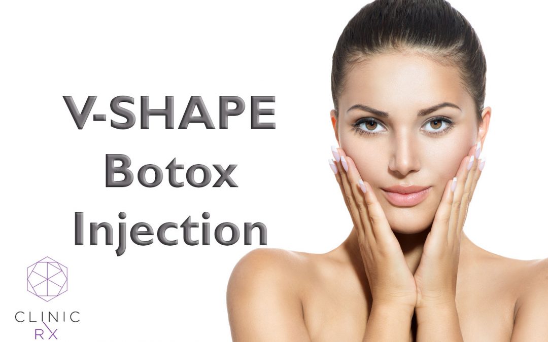 V-SHAPE Botox Injection