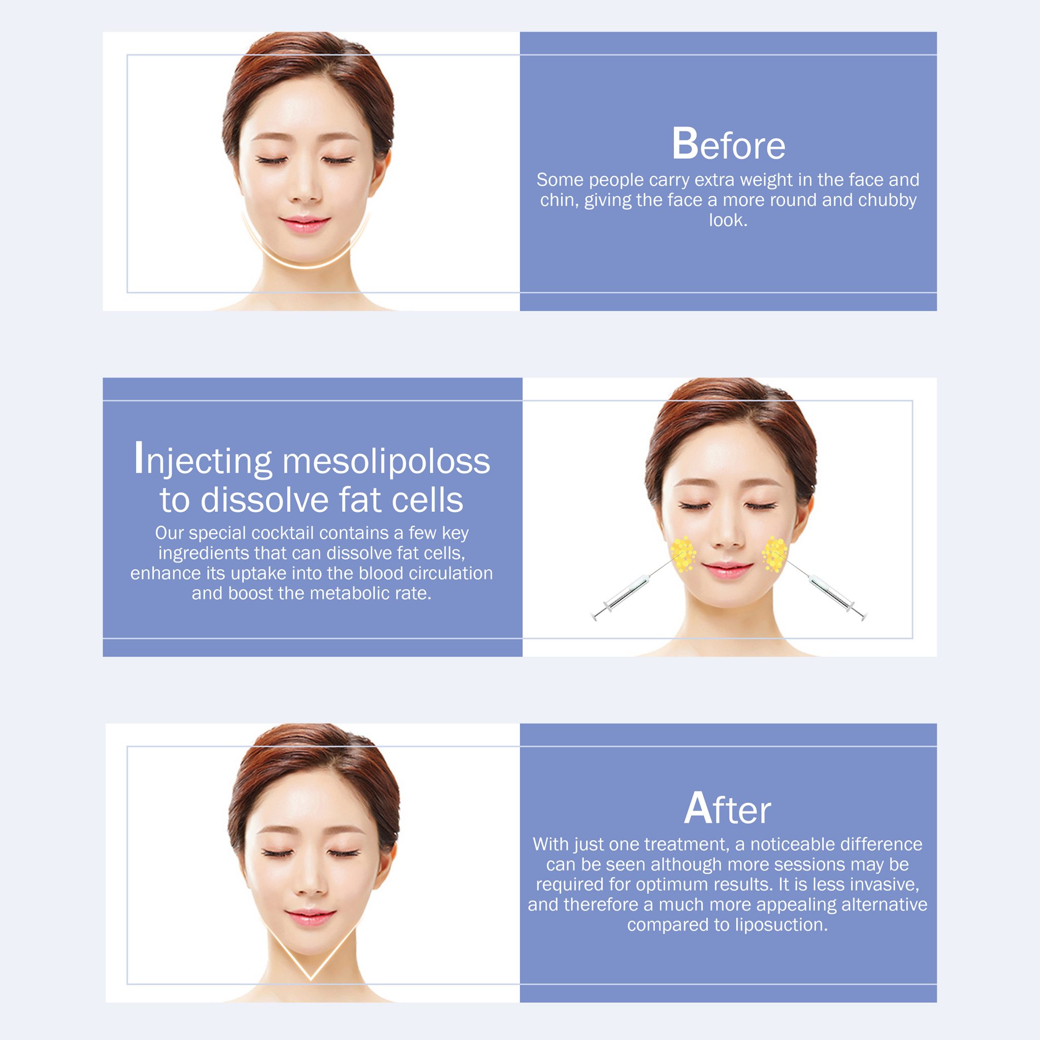 Face Slimming