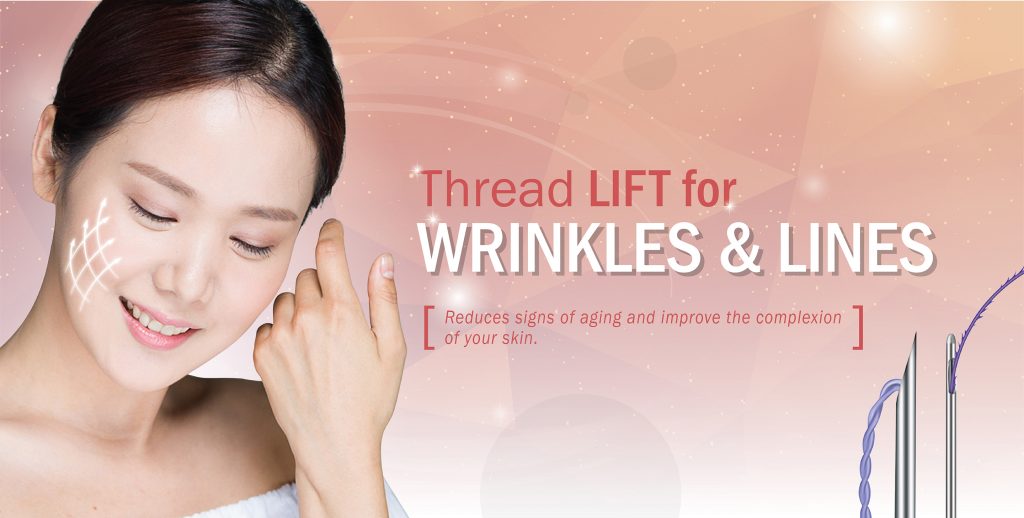 Thread Lift for Wrinkles & Lines Clinic RX